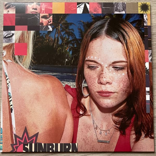 FIKE, DOMINIC – SUNBURN